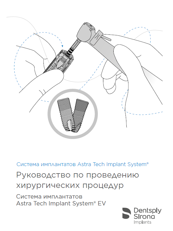 Хирургический протокол Astra Tech EV