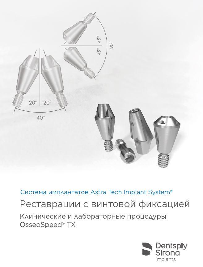 Реставрации с винтовой фиксацией. Система имплантатов Astra Tech Implant System®. 
